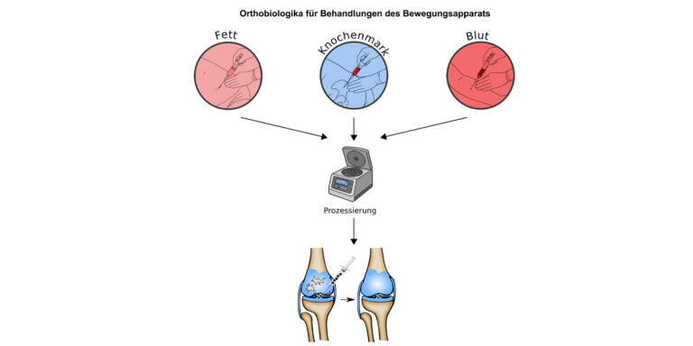 Orthobiologika